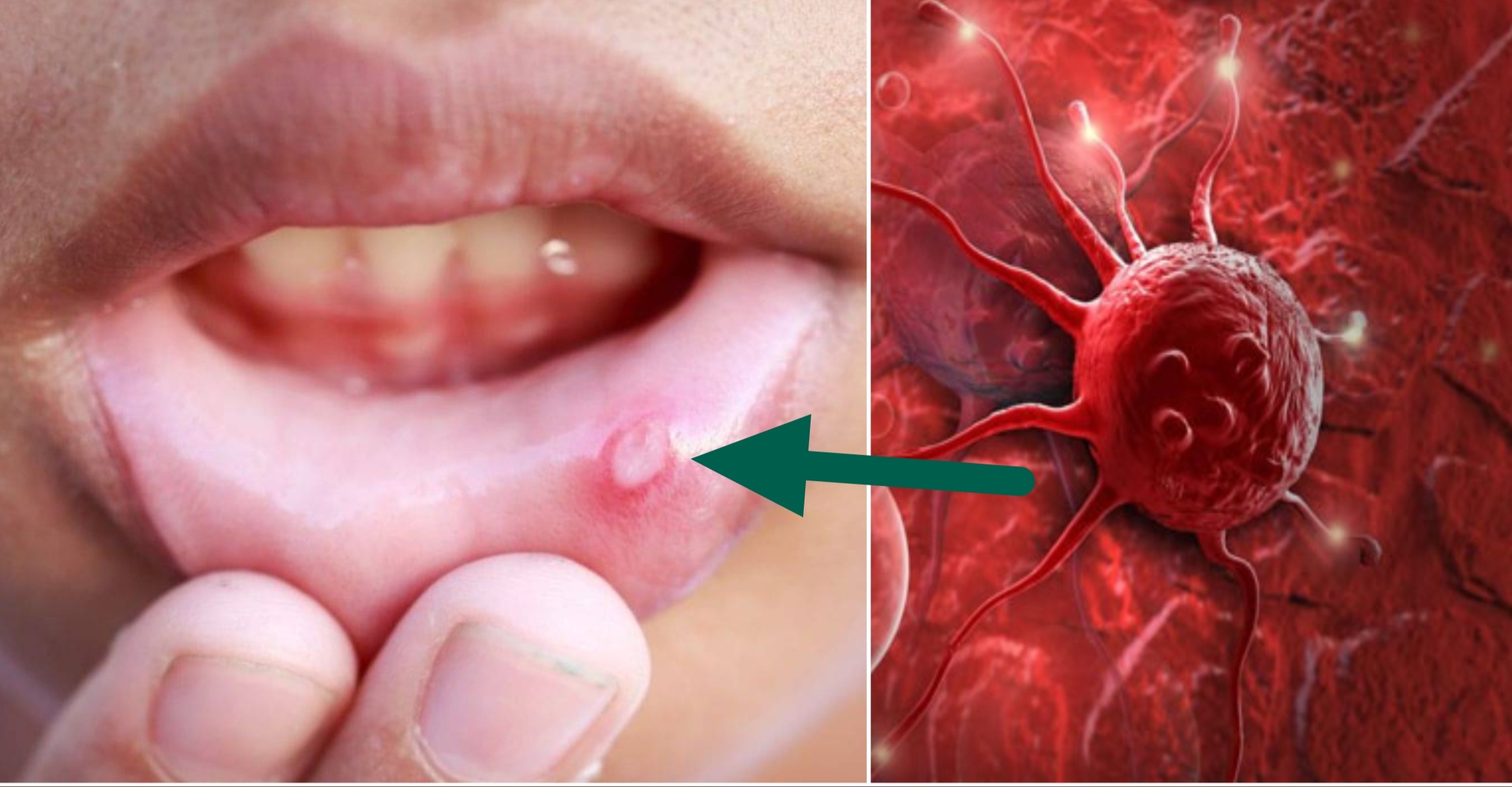 ক্যান্সারের প্রাথমিক লক্ষণ সম্পর্কে সচেতনতা