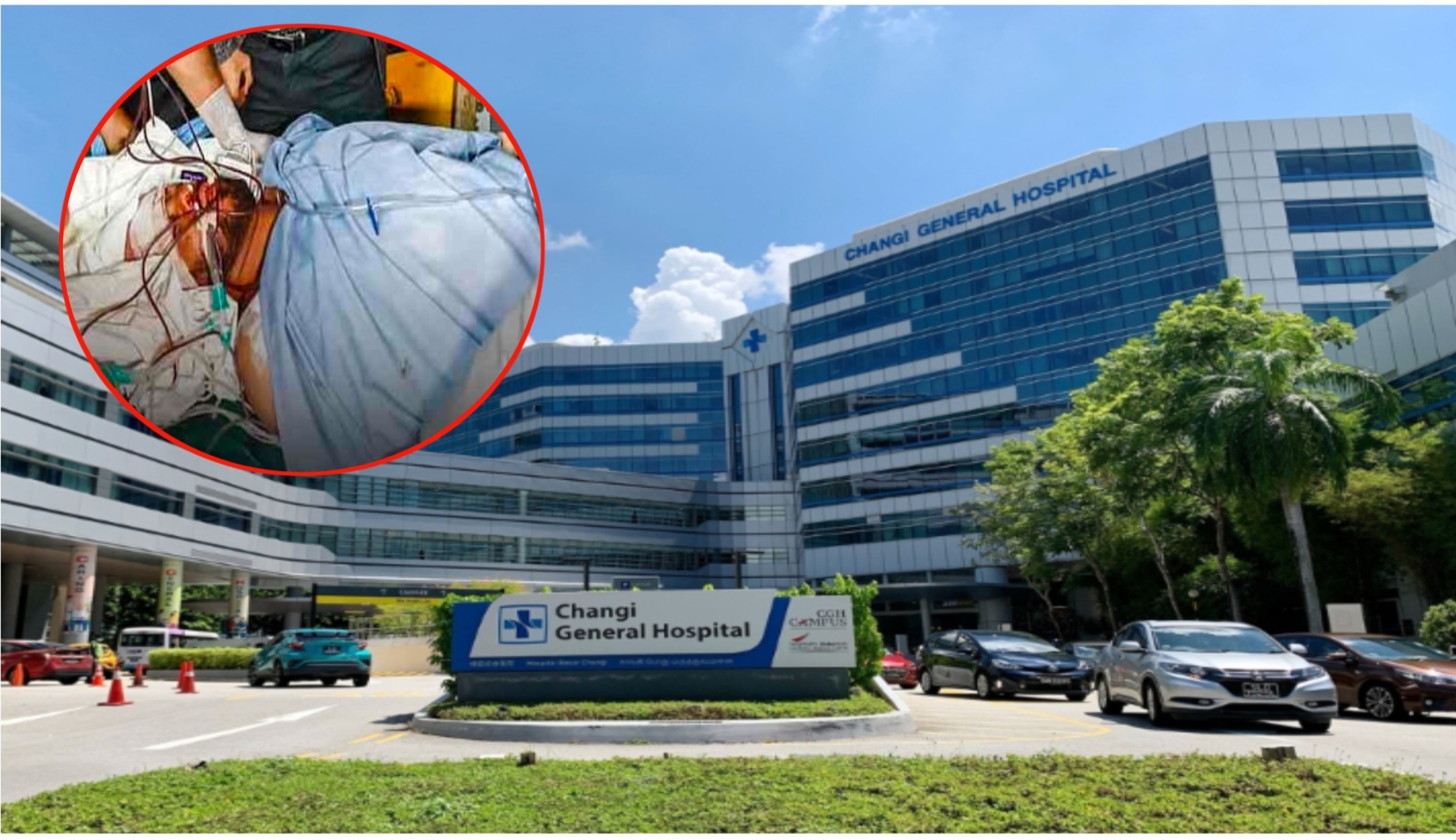 সংকটাপন্ন অবস্থায় সিঙ্গাপুর হাসপাতালে শরীফ ওসমান হাদি