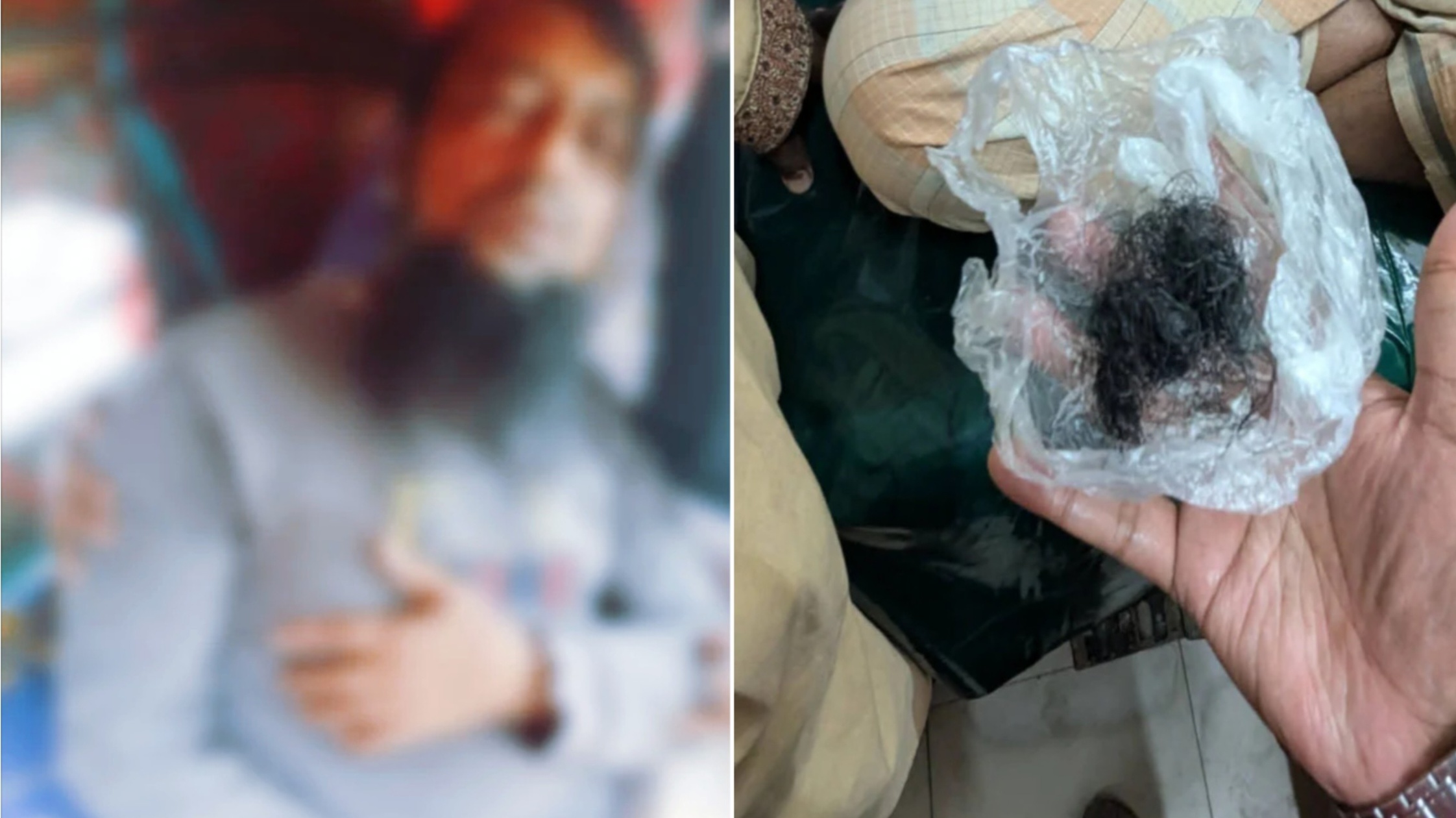 ফেনীতে নির্বাচনি বিরোধের ঘটনায় জামায়াত কর্মী আহত