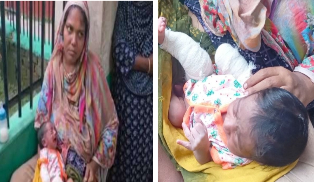 দিনাজপুরে মাদকাসক্ত মা-বাবার নির্যাতনের শিকার নবজাতক শিশুর ঘটনা